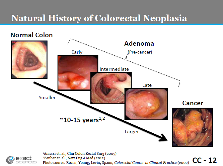 Photos: Natural history of colorectal neoplasia