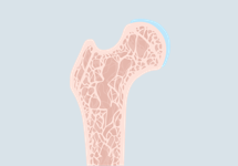cross-section of bone
