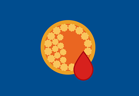 a graphic representation of blood drops leaking from a vein
